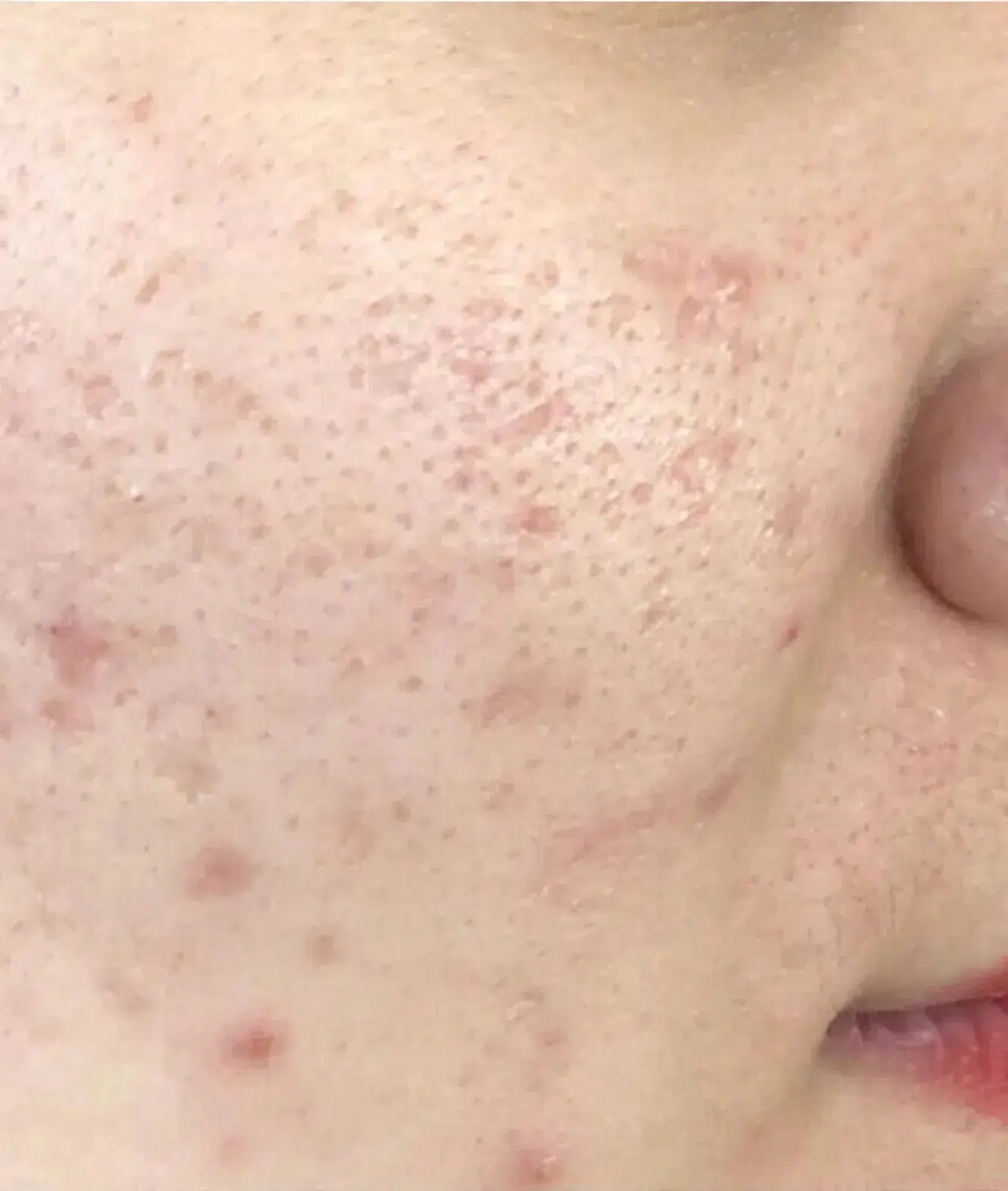 Dull skin tone — Before treatment · Case 2 · Luowei Medical Aesthetics Clinic