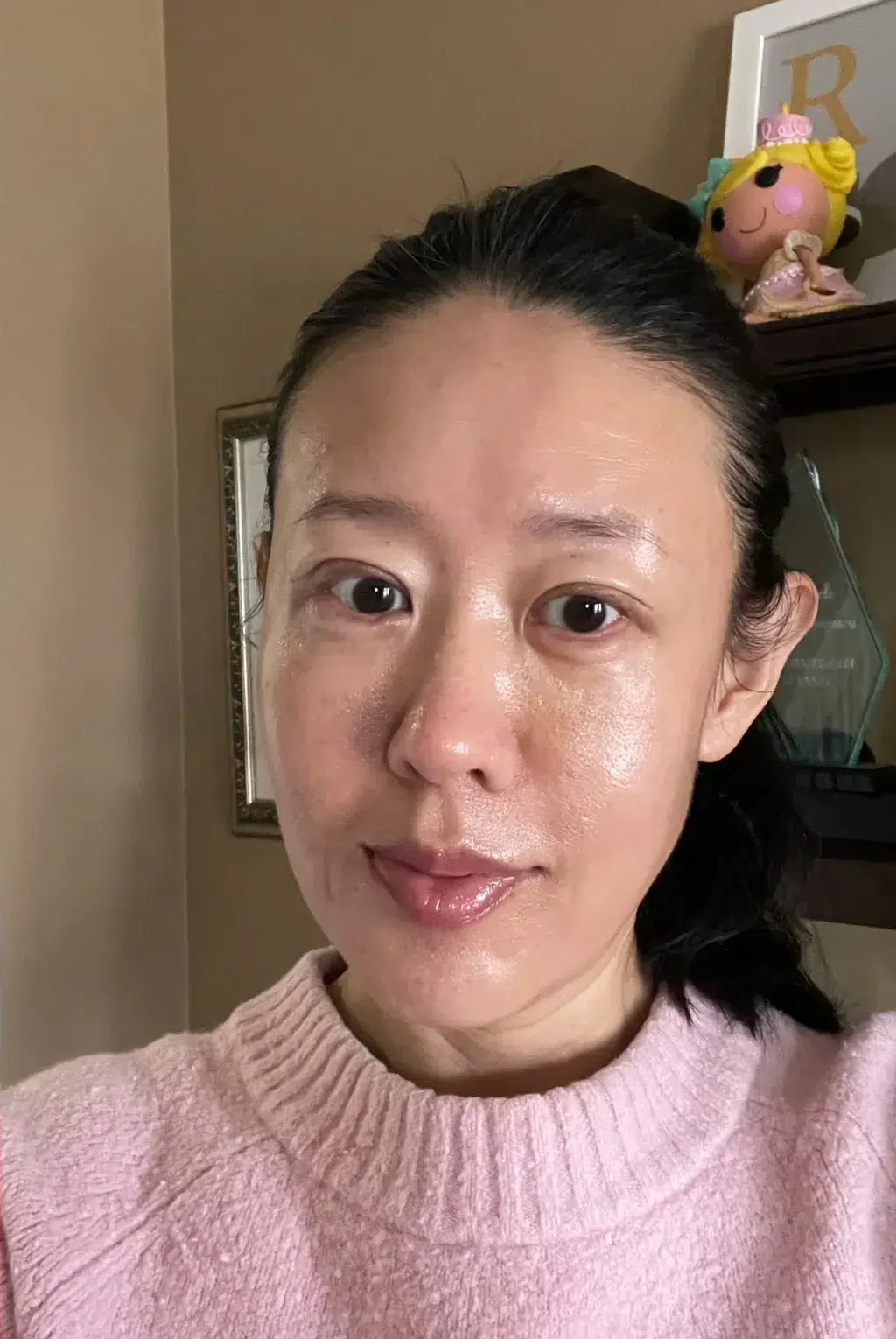 Luowei Skeletal facial contouring — After · Case 9 · Luowei
