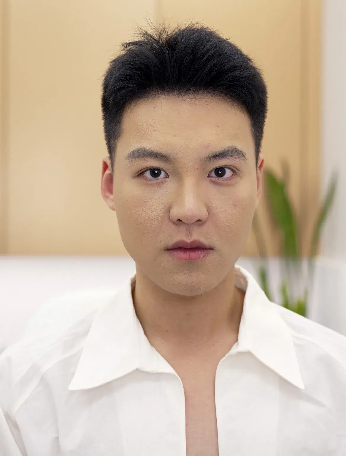 Post-Treatment Scars · Case 02 · Luowei Medical Aesthetics Clinic