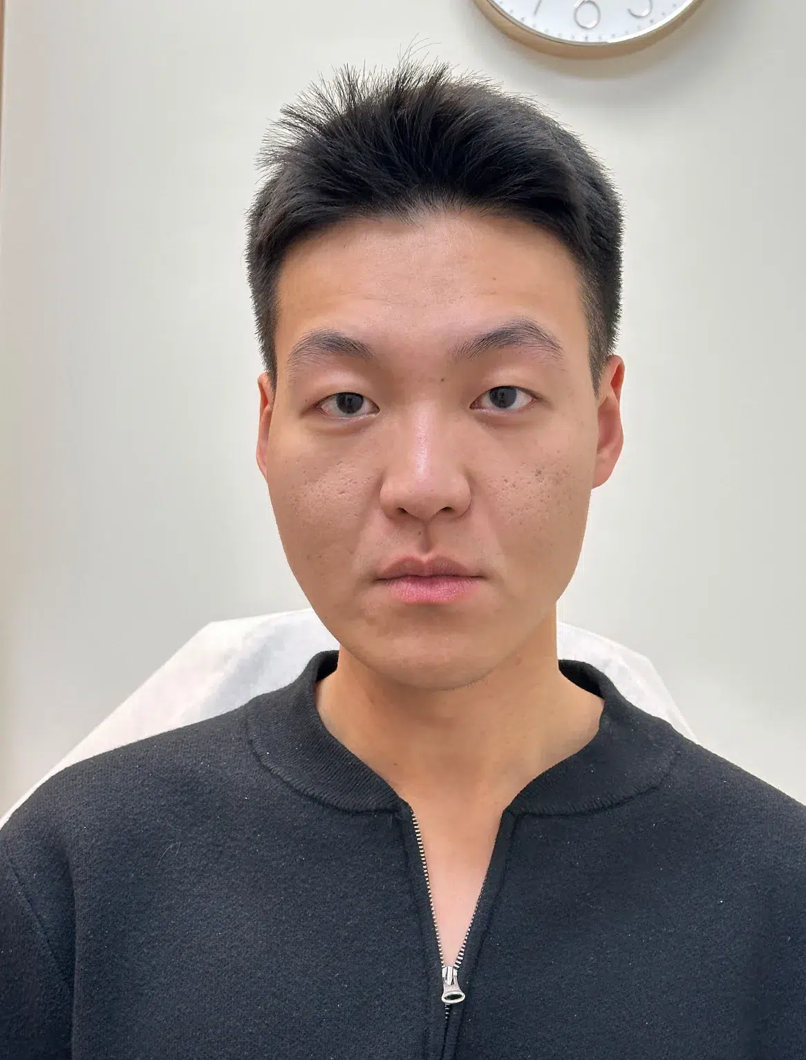Before Scar Treatment · Case 02 · Luowei Medical Aesthetics Clinic
