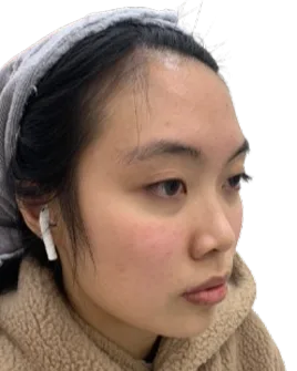 Receding chin Before · Case 10 · Luowei Medical Aesthetics Clinic