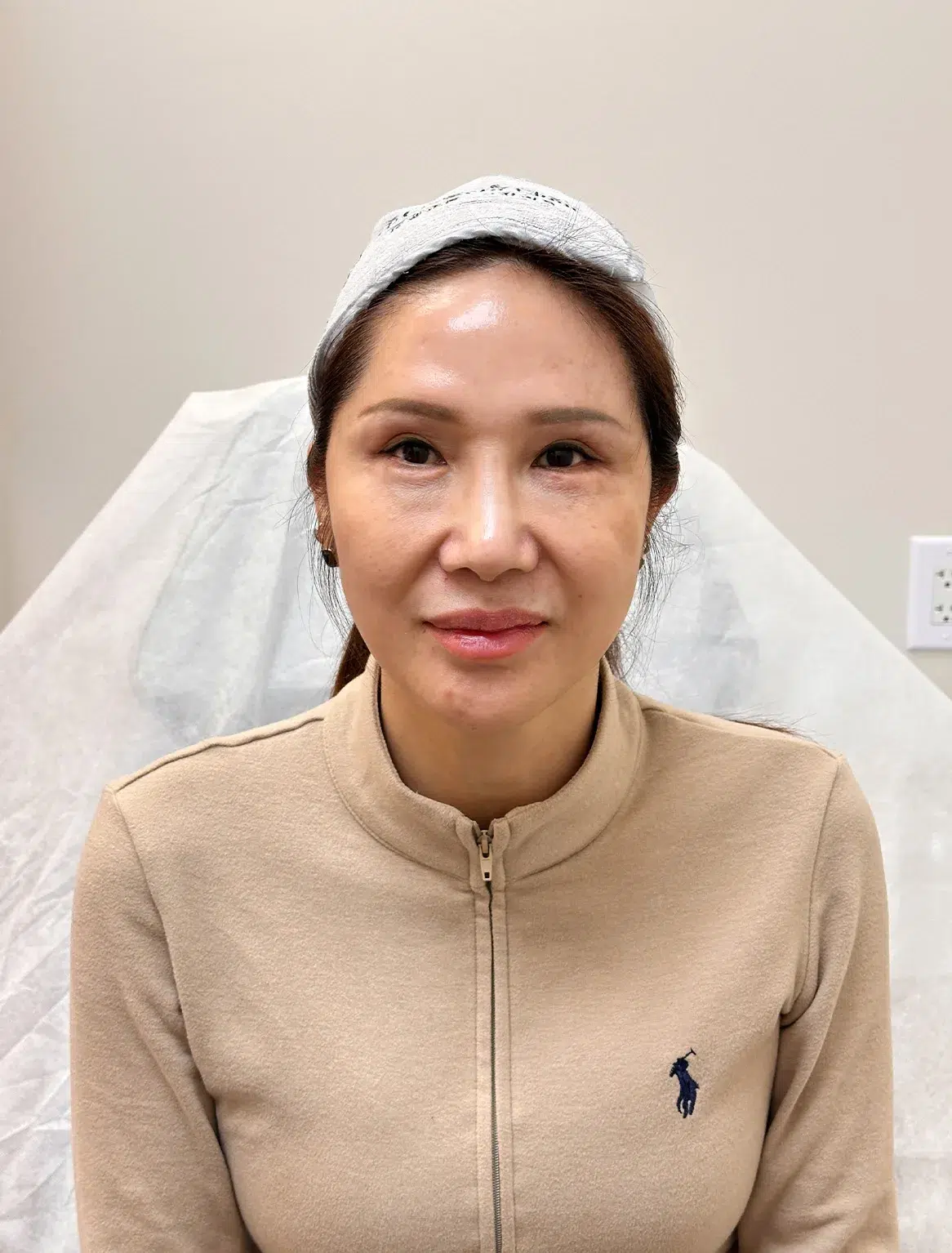 Skin laxity After · Case 36 · Luowei Medical Aesthetics Clinic