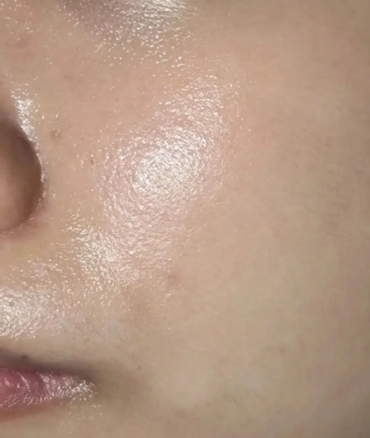 Skin Dullness After Treatment · Case 04 · Luowei Medical Aesthetics Clinic