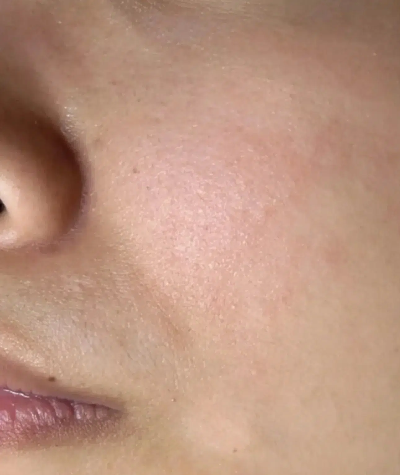 Skin Dullness Before Treatment · Case 04 · Luowei Medical Aesthetics Clinic