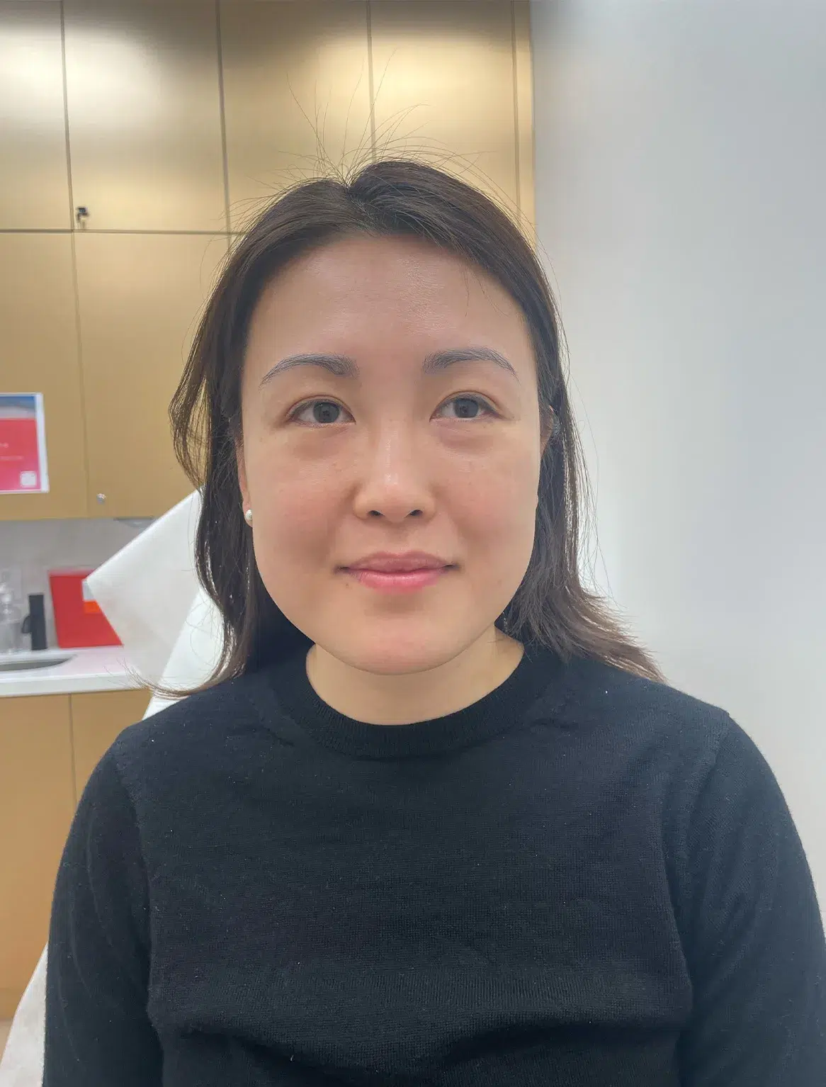Volume loss Before · Case 31 · Luowei Medical Aesthetics Clinic